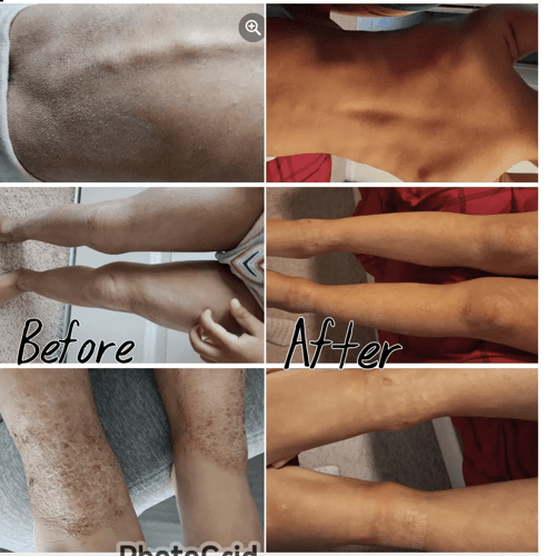 Before_After-Andrea.png Before_After-Andrea.png